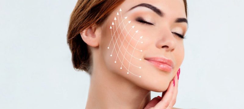 non-surgical-face-lift