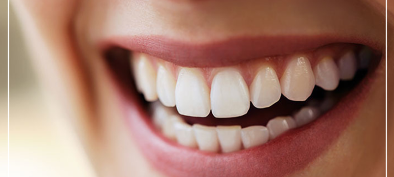 dental-aesthetics