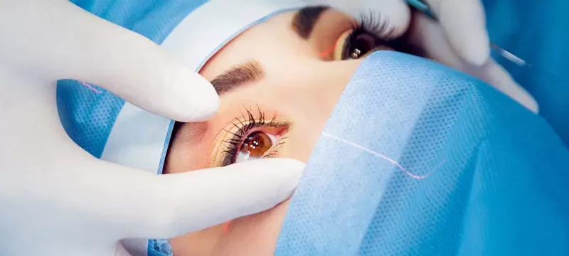 lasik-turkey-istanbul