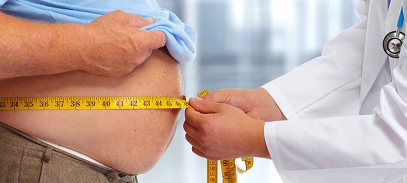 obesity-surgery