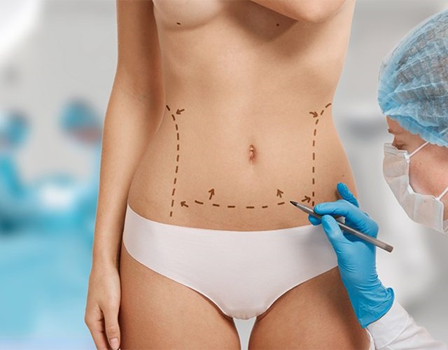 vaser-liposuction-640x492