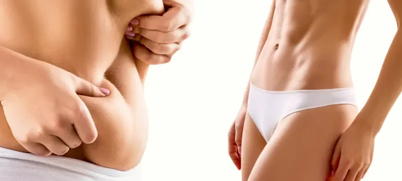 karin-germe-ameliyati