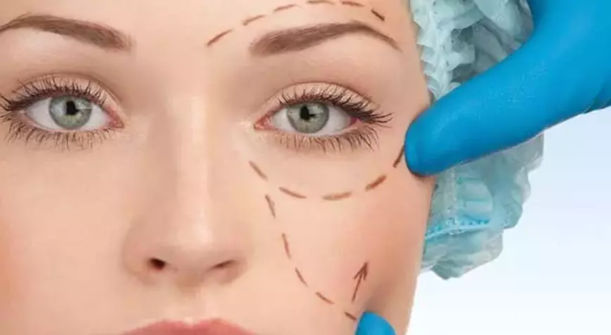 badem göz estetiği