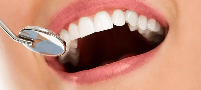 siddetli-bulanti-refleksi