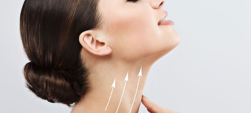 neck-lift